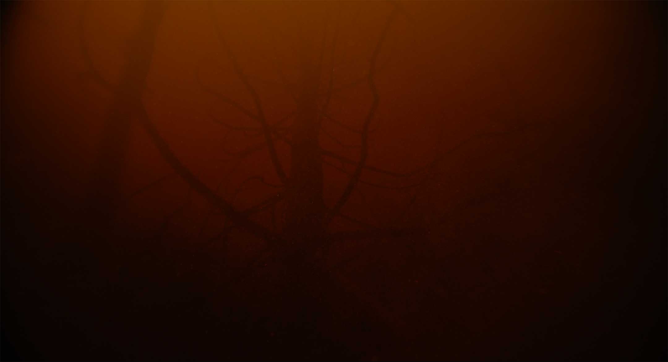 Forets-still4(300dpi)